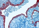 1_LifeScience_Patho_Gal1