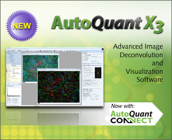 Autoquant 2