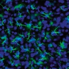 apotome_multichannelfluorescence_brainrat_sm