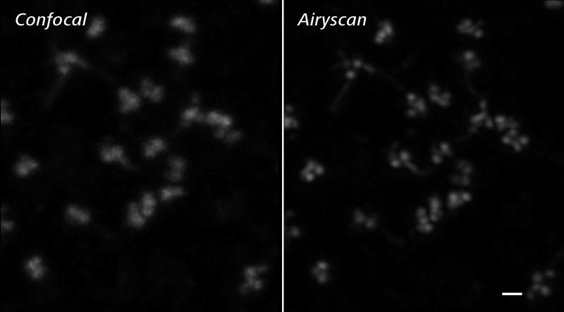 confocal_airyscan_chlamydia_lsm-800